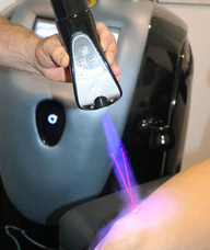 Book an Appointment with Local Cryotherapy for Local Cryotherapy